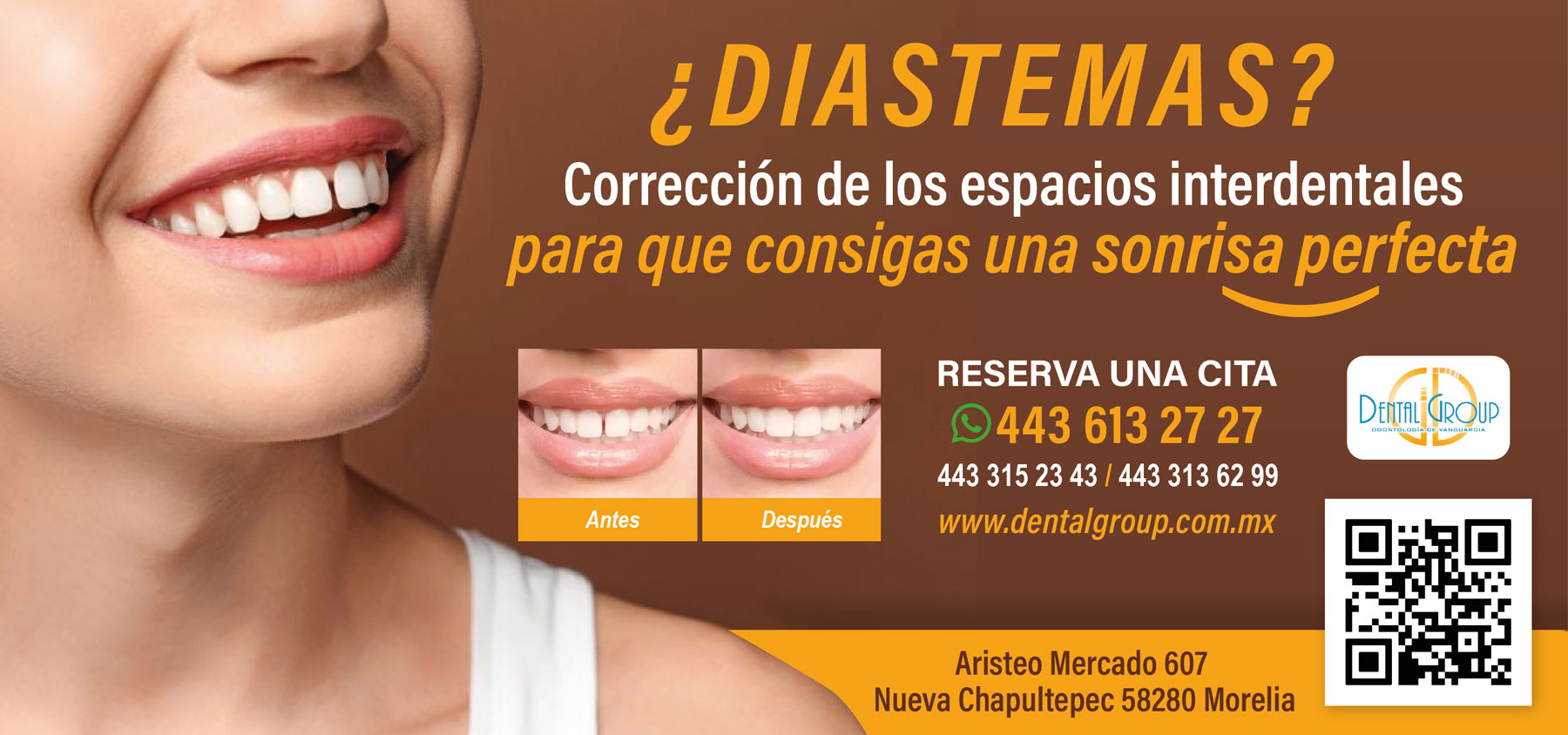 Dental-Group-banner-diastemas