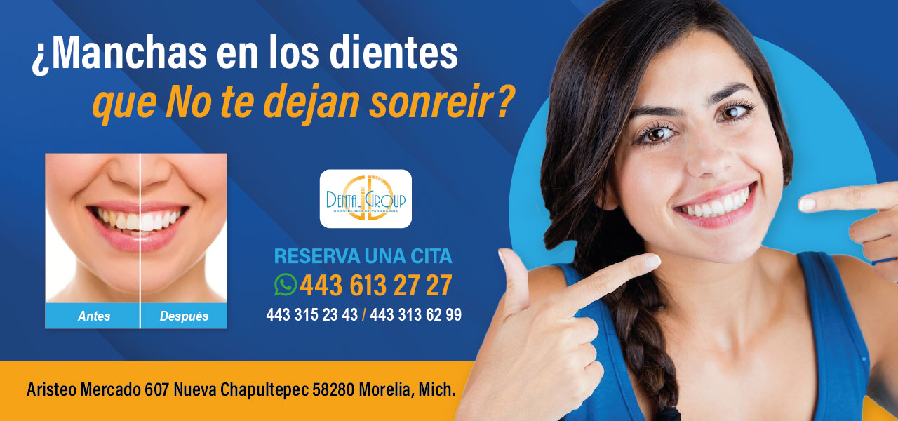 Dental-Group-banner-fluorosis2