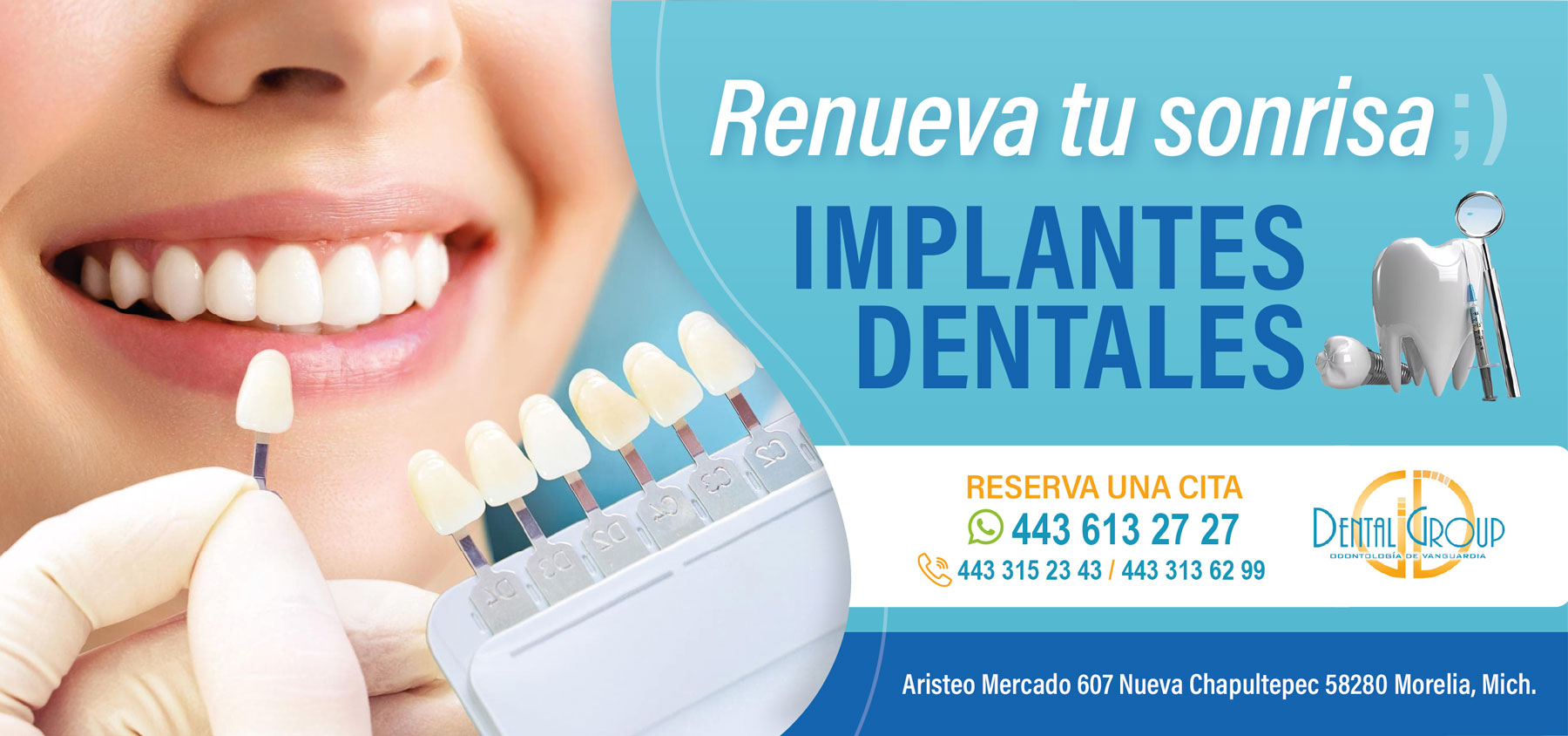 Dental-Group-banner-implantes